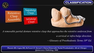 Direct Retainers and Esthetic Clasps - Removable Partial Dentures | PDF