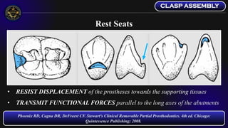 Direct Retainers and Esthetic Clasps - Removable Partial Dentures | PDF