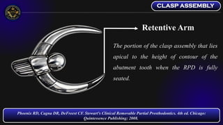 Direct Retainers and Esthetic Clasps - Removable Partial Dentures | PDF