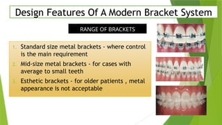 Comprehensive Overview of MBT Orthodontic Philosophy and Appliance ...