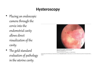 5.Abnormal Uterine Bleeding (1).pptx health science | PPTX