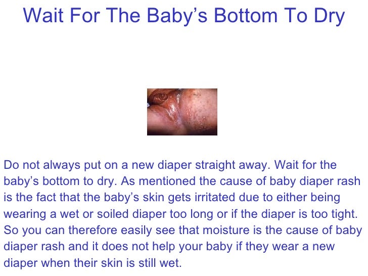 Baby Diaper Rash A Mothers Worse Nightmare