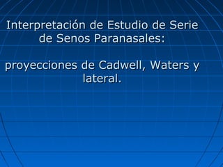 Interpretación de Estudio de SerieInterpretación de Estudio de Serie
de Senos Paranasales:de Senos Paranasales:
proyecciones de Cadwell, Waters yproyecciones de Cadwell, Waters y
lateral.lateral.
 