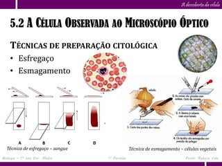 Capítulo
                      5                                                A descoberta da célula


    5.2 A CÉLULA OBSERVADA AO MICROSCÓPIO ÓPTICO
    TÉCNICAS DE PREPARAÇÃO CITOLÓGICA
    • Esfregaço
    • Esmagamento




  Técnica de esfregaço – sangue                Técnica de esmagamento – células vegetais
Biologia – 1º ano Ens. Médio      1º Período                             Profa. Rebeca Vale
 