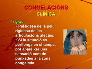 CLÍNICA CONGELACIONS 1r grau: Pal·lidesa de la pell, rigidesa de les articulacions afectes. Si la situació es perllonga en el temps, pot aparèixer una sensació com de punxades a la zona congelada. 