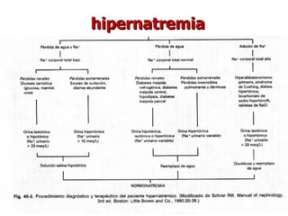 hipernatremia 