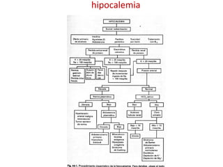 hipocalemia 