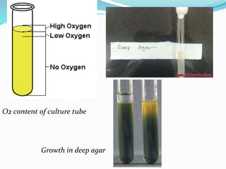 O2 content of culture tube
Growth in deep agar
 