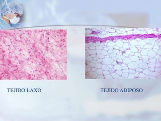 TEJIDO LAXO                                            TEJIDO ADIPOSO