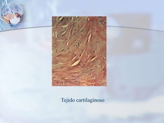 Tejido cartilaginoso