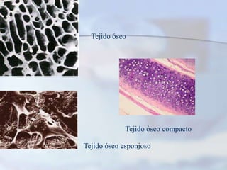 Tejido óseoTejido óseo compactoTejido óseo esponjoso