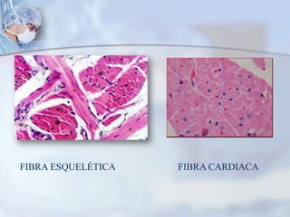 FIBRA ESQUELÉTICA                          FIBRA CARDIACA