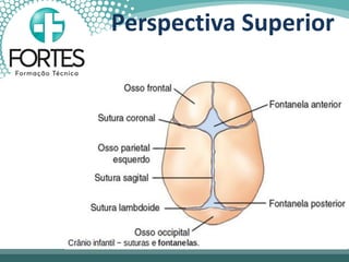 Perspectiva Superior
 