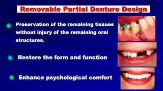Preservation of the remaining tissues
without injury of the remaining oral
structures.
Restore the form and function
Enhance psychological comfort
Removable Partial Denture Design
 