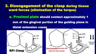 3. Disengagement of the clasp during tissue
ward forces (elimination of the torque)
a. Proximal plate should contact approximately 1
mm of the gingival portion of the guiding plane in
distal extension cases
RPIRPI Clasp
 