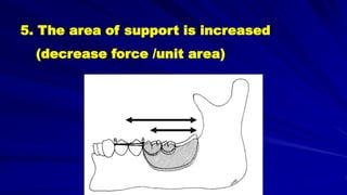 5. The area of support is increased
(decrease force /unit area)
 