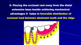6. Placing the occlusal rest away from the distal
extension base beside achieving mechanical
advantages it helps in favorable distribution of
occlusal load between abutment tooth and the ridge
 