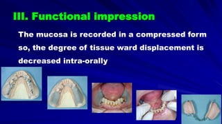 III. Functional impression
The mucosa is recorded in a compressed form
so, the degree of tissue ward displacement is
decreased intra-orally
 