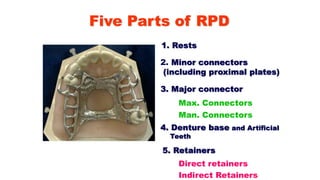 Five Parts of RPD
1. Rests
2. Minor connectors
(including proximal plates)
3. Major connector
4. Denture base and Artificial
Teeth
5. Retainers
Direct retainers
Indirect Retainers
Max. Connectors
Man. Connectors
 