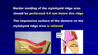 Border molding of the mylohyoid ridge area
should be performed 4-6 mm below this ridge
The impression surface of the denture on the
mylohyoid ridge area is relieved
Relief
area
Relief
area
 