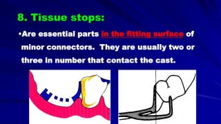 8. Tissue stops:
•Are essential parts in the fitting surface of
minor connectors. They are usually two or
three in number that contact the cast.
 