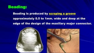 Beading:
Beading is produced by scraping a groove
approximately 0.5 to 1mm. wide and deep at the
edge of the design of the maxillary major connector.
 