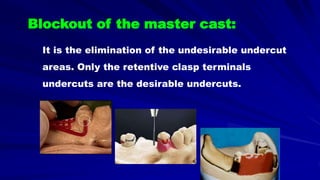 It is the elimination of the undesirable undercut
areas. Only the retentive clasp terminals
undercuts are the desirable undercuts.
Blockout of the master cast:
 
