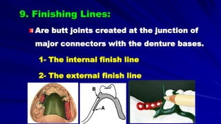 9. Finishing Lines:
Are butt joints created at the junction of
major connectors with the denture bases.
1- The internal finish line
2- The external finish line
 