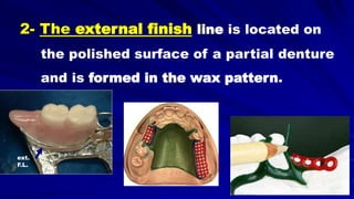 2- The external finish line is located on
the polished surface of a partial denture
and is formed in the wax pattern.
ext.
F.L.
 