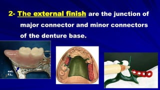 ext.
F.L.
2- The external finish are the junction of
major connector and minor connectors
of the denture base.
 