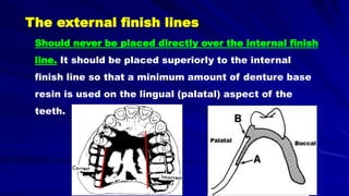 Should never be placed directly over the internal finish
line. It should be placed superiorly to the internal
finish line so that a minimum amount of denture base
resin is used on the lingual (palatal) aspect of the
teeth.
Palatal
Buccal
The external finish lines
 
