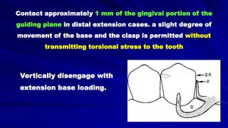 Contact approximately 1 mm of the gingival portion of the
guiding plane in distal extension cases. a slight degree of
movement of the base and the clasp is permitted without
transmitting torsional stress to the tooth
Vertically disengage with
extension base loading.
 