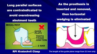 As the prosthesis is
inserted and removed,
thus horizontal
wedging is eliminated
Long parallel surfaces
are contraindicated to
avoid overstressing
abutment teeth
The length of the guide plane range from 2-3 mm onlyRPI Kratochvil Clasp
 