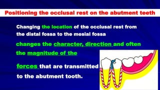 Positioning the occlusal rest on the abutment teeth
Changing the location of the occlusal rest from
the distal fossa to the mesial fossa
changes the character, direction and often
the magnitude of the
forces that are transmitted
to the abutment tooth.
 