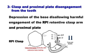 Depression of the base disallowing harmful
engagement of the RPI retentive clasp arm
and proximal plate
3- Clasp and proximal plate disengagement
from the tooth
RPI Clasp
 