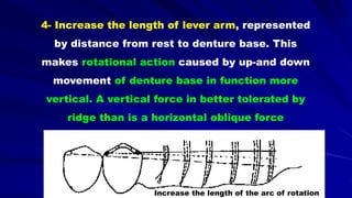 4- Increase the length of lever arm, represented
by distance from rest to denture base. This
makes rotational action caused by up-and down
movement of denture base in function more
vertical. A vertical force in better tolerated by
ridge than is a horizontal oblique force
Increase the length of the arc of rotation
 