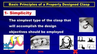 Basic Principles of a Properly Designed Clasp
1- Simplicity
The simplest type of the clasp that
will accomplish the design
objectives should be employed
R.P.AR.P.I
 