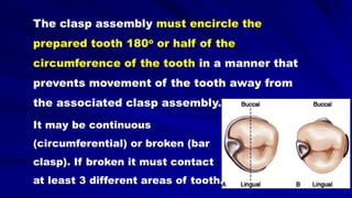 The clasp assembly must encircle the
prepared tooth 180o or half of the
circumference of the tooth in a manner that
prevents movement of the tooth away from
the associated clasp assembly.
It may be continuous
(circumferential) or broken (bar
clasp). If broken it must contact
at least 3 different areas of tooth.
 