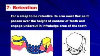 For a clasp to be retentive its arm must flex as it
passes over the height of contour of tooth and
engage undercut in infrabulge area of the teeth
7- Retention
 