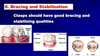 Clasps should have good bracing and
stabilizing qualities
8. Bracing and Stabilization
 