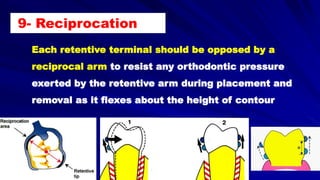 9- Reciprocation
Each retentive terminal should be opposed by a
reciprocal arm to resist any orthodontic pressure
exerted by the retentive arm during placement and
removal as it flexes about the height of contour
 