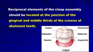 Reciprocal elements of the clasp assembly
should be located at the junction of the
gingival and middle thirds of the crowns of
abutment teeth.
 