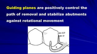 Guiding planes are positively control the
path of removal and stabilize abutments
against rotational movement
 