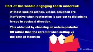 Part of the saddle engaging teeth undercut:
This obtained by choosing an antero-posterior
tilt rather than the zero tilt when setting up
the path of insertion
Without guiding planes, Clasps designed are
ineffective when restoration is subject to dislodging
forces in occlusal direction.
Dr. Amr Hosny
 