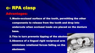 1.Mesio-occlusal surface of the tooth, permitting the other
components to release from the tooth and drop into
undercuts when occlusal loads are placed on the denture
base.
Advantages:
c- RPA clasp
2.This in turn prevents tipping of the abutment.
3.Absence of a lingual rigid reciprocal arm
minimizes rotational forces falling on the
abutment.
 