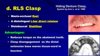 d. RLS Clasp
 Mesio-occlusal Rest
 A distolingual L-bar direct retainer
 Distobuccal Stabilizer
Advantages:
• Reduces torque on the abutment tooth.
• Clasp disengagement as the distal
extension base moves tissue-ward in
function
Hiding Denture Clasp,
System by Aviv L. et al. 1990
 