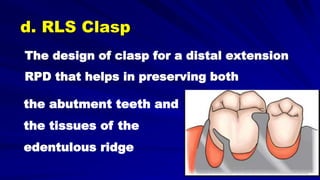 The design of clasp for a distal extension
RPD that helps in preserving both
the abutment teeth and
the tissues of the
edentulous ridge
d. RLS Clasp
 