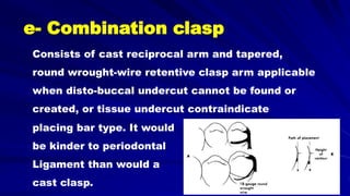 e- Combination clasp
Consists of cast reciprocal arm and tapered,
round wrought-wire retentive clasp arm applicable
when disto-buccal undercut cannot be found or
created, or tissue undercut contraindicate
placing bar type. It would
be kinder to periodontal
Ligament than would a
cast clasp.
 