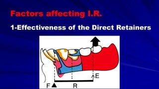 1-Effectiveness of the Direct Retainers
Factors affecting I.R.
 