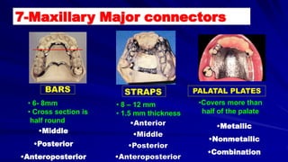 STRAPSBARS PALATAL PLATES
• 6- 8mm
• Cross section is
half round
• 8 – 12 mm
• 1.5 mm thickness
•Covers more than
half of the palate
•Anterior
•Middle
•Posterior
•Anteroposterior
•Middle
•Posterior
•Anteroposterior
•Metallic
•Nonmetallic
•Combination
7-Maxillary Major connectors
 